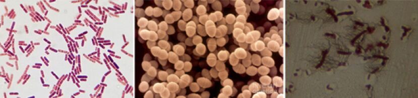 E. coli, fecale enterococcus en proteus zijn de belangrijkste veroorzakers van chronische bacteriële prostatitis
